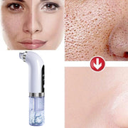 Aspirateur hydra faciale, un nettoyage de peau efficace.